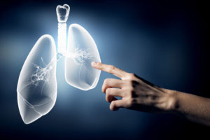câncer no pulmão
