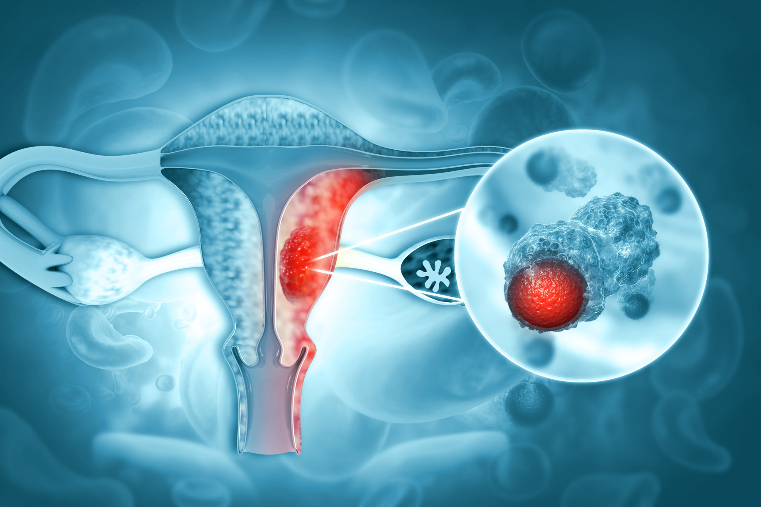 Biópsia Endometrial