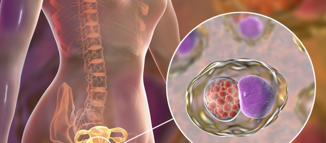 câncer de colo do útero