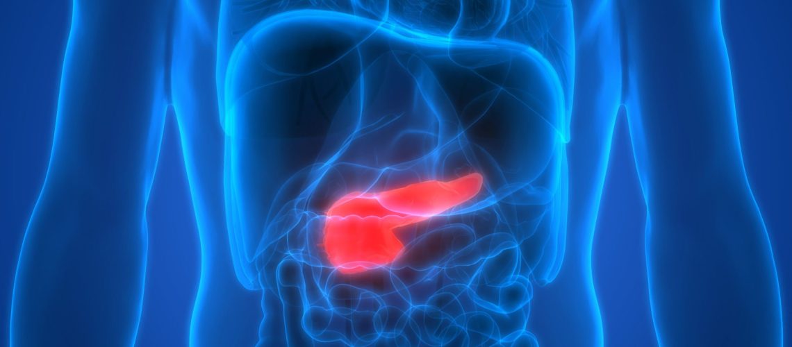 Câncer de pâncreas