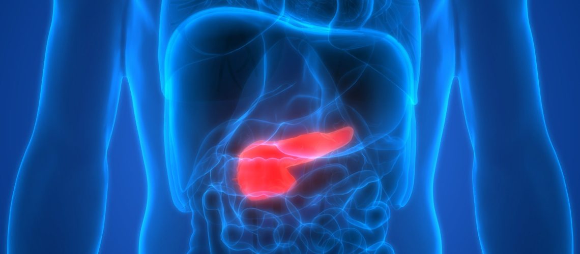 Câncer de pâncreas