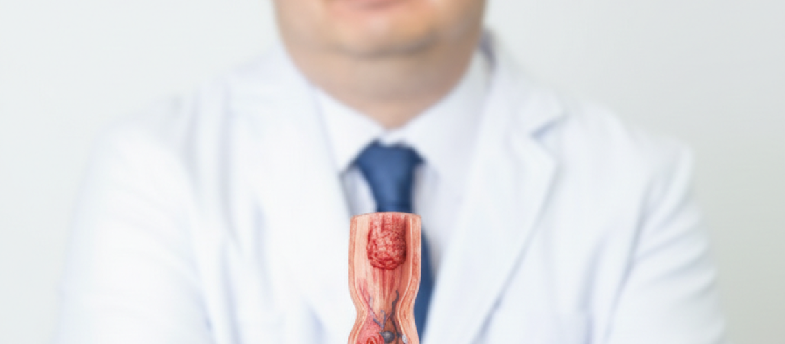 Avanços Recentes no Tratamento Perioperatório do Câncer de Esôfago_ O Papel da Imunoterapia e da Quimioterapia Combinadas