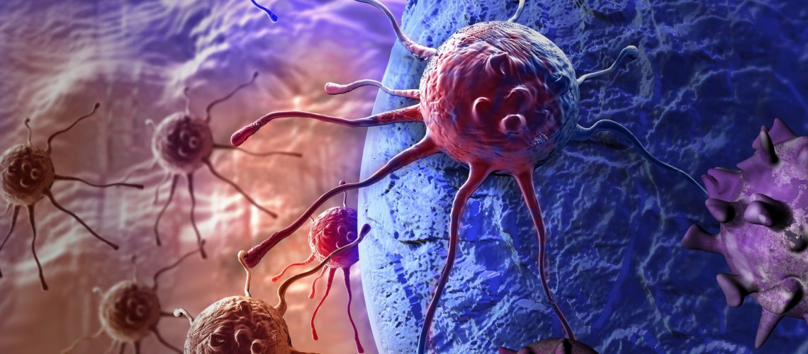 Câncer de Estômago