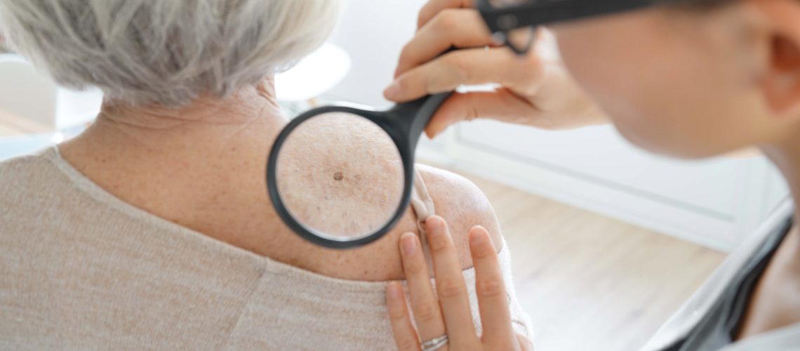 Senior woman getting skin checked by dermatologist