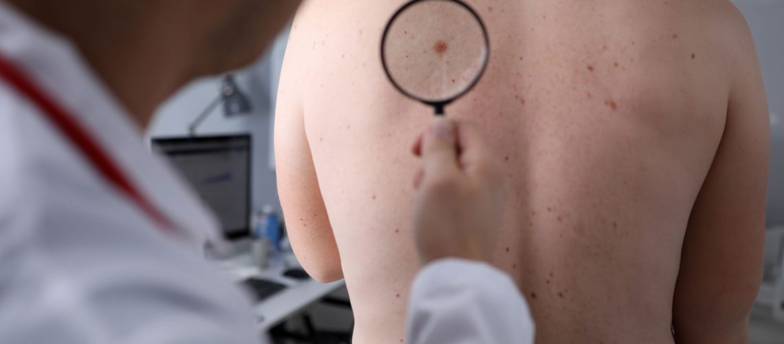 Oncologista em São Paulo