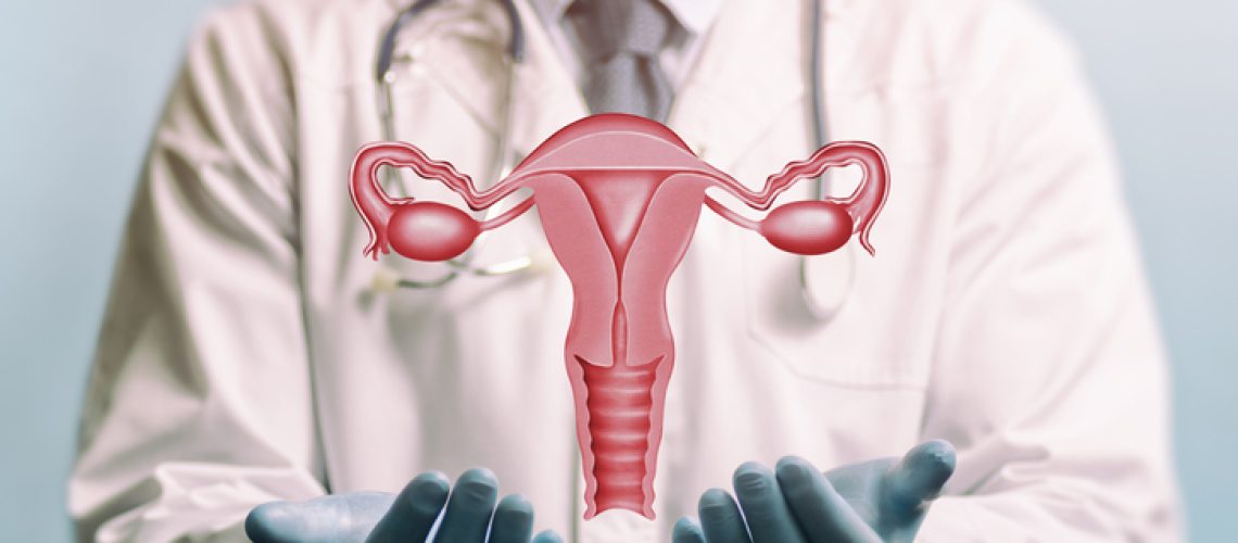 retirada dos ovários