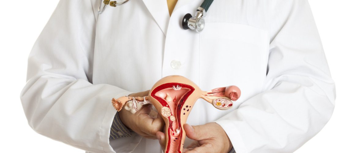 câncer de endométrio