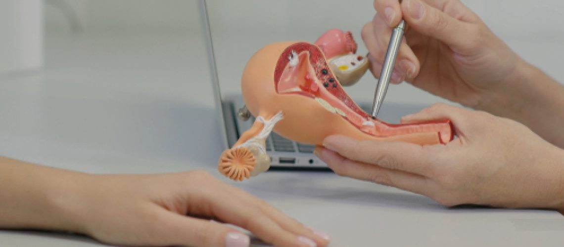 câncer de colo uterino