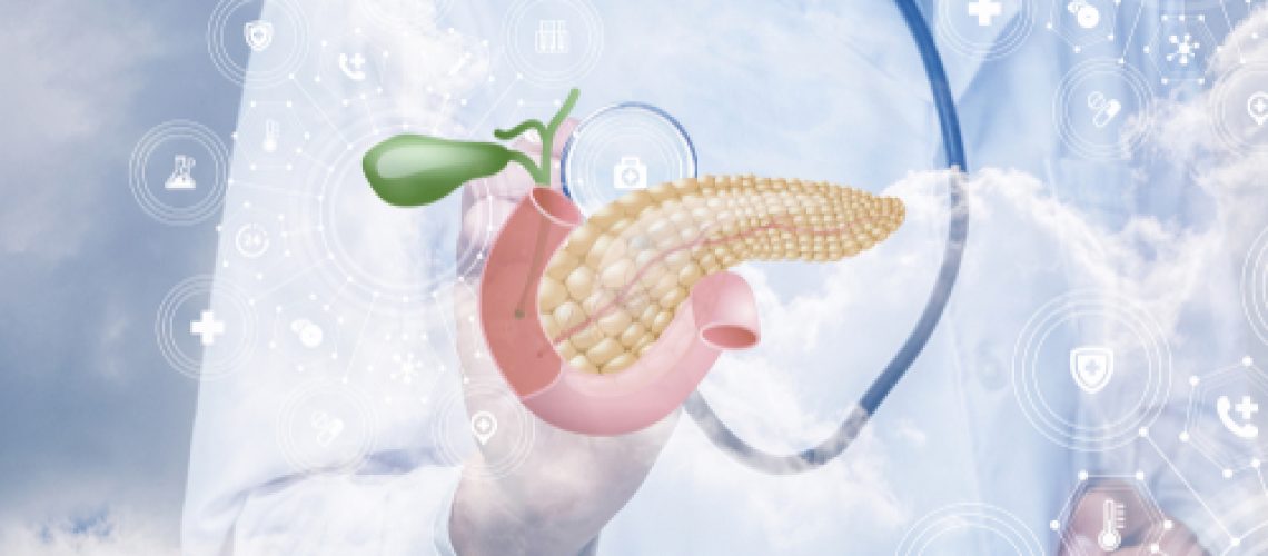 câncer de pâncreas